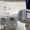 Merida Diode Laser for laser hair removal based on Android