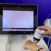 Diamond is the most powerful diode laser for laser hair removal and skin rejuvenation